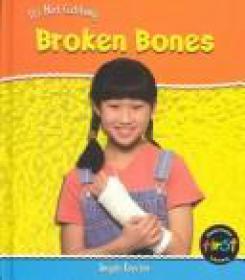 Broken Bones - The X Ray Atlas of fractures [EPUB] [UnitedVRG]