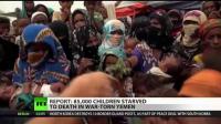 Illegal War On Yemen Kills 130 Children Per Day - Trump Not Phased
