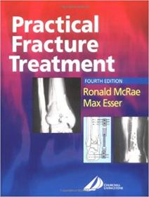 Practical Fracture Treatment, 4th Edition