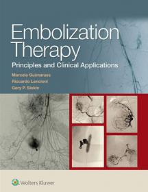 Embolization Therapy- Principles and Clinical Applications