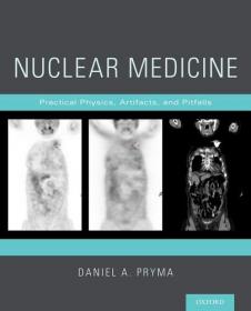 Nuclear Medicine- Practical Physics, Artifacts, and Pitfalls