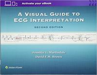 A Visual Guide to ECG Interpretation, 2nd edition