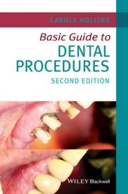 Basic Guide to Dental Procedures (Basic Guide Dentistry Series), 2nd Edition