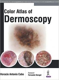 [ TutGee com ] Colour Atlas of Dermoscopy 1st Edition