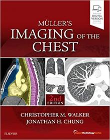 Muller's Imaging of the Chest - Expert Radiology Series 2nd Edition