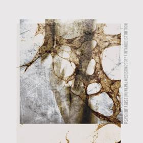 Psychofagist [w-Napalmed] - Songs of Faint and Distortion (2013) [WMA] [Fallen Angel]