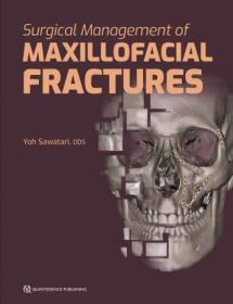 Surgical Management of Maxillofacial Fractures 1st Edition