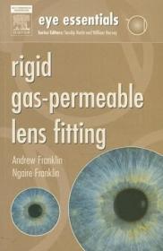 Eye Essentials - Rigid Gas-Permeable Lens Fitting
