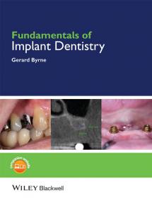 Fundamentals of Implant Dentistry [PDF] [StormRG]