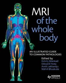 MRI of the Whole Body, An Illustrated Guide [PDF] [StormRG]