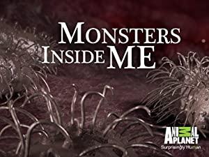Monsters Inside Me S05E06 Vampire Parasites Attack 480p HDTV x264-mSD