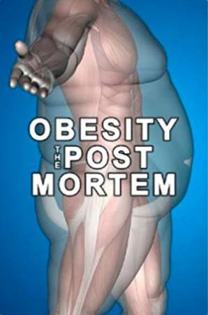 Obesity The Post Mortem 2016 WEBRip XviD MP3-XVID