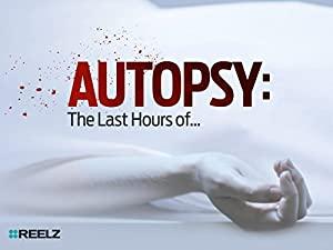 Autopsy The Last Hours Of S08E04 John Candy 720p HDTV x264-eSc[eztv]